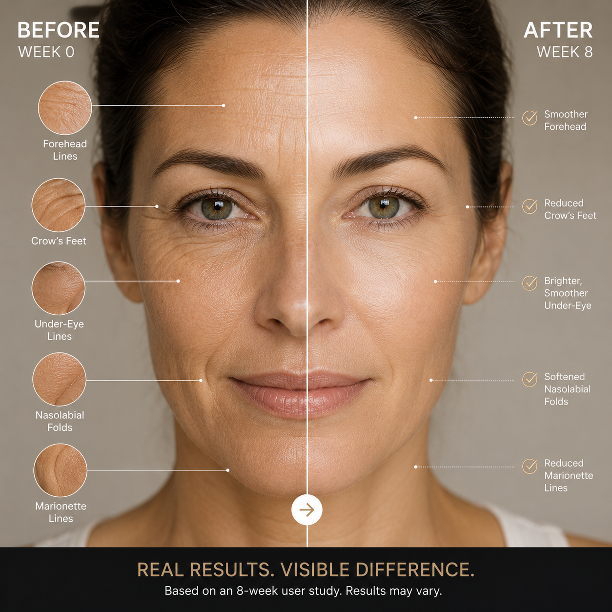 QINGLIN Anti-WrinkleFace Cream-EDC