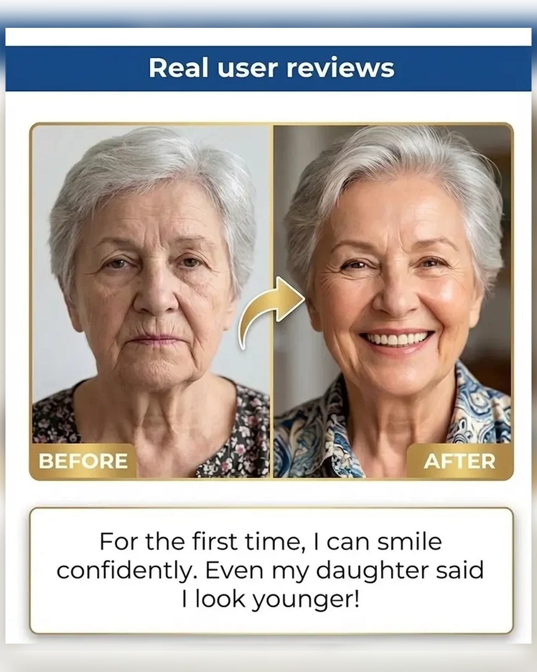 🏆Ends Today: 50% OFF! 🏆2026 Bestselling Product🦷